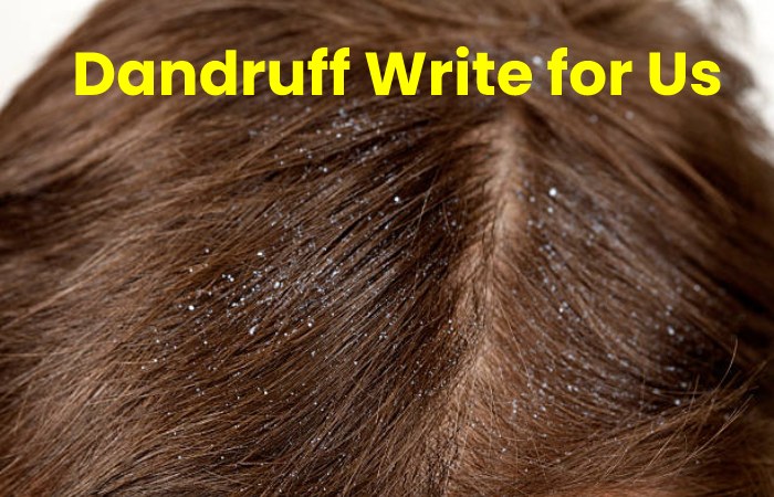 Dandruff Write for Us
