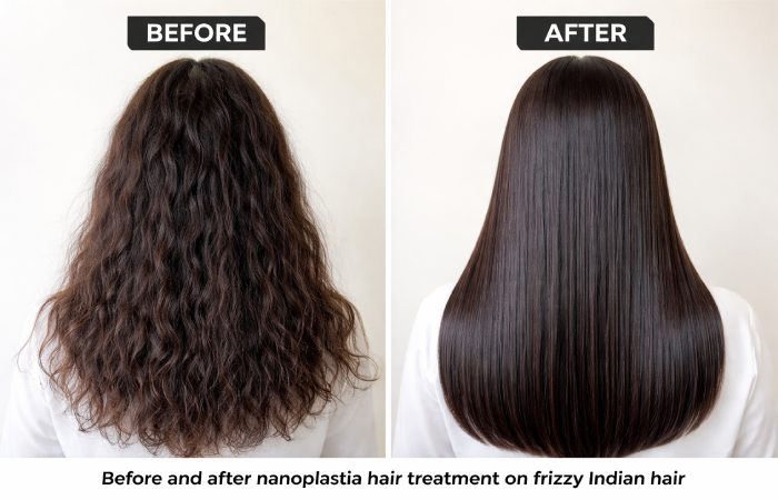 nanoplastia hair treatment before and after result India